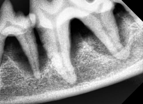口腔内X 線写真左下顎P4M1